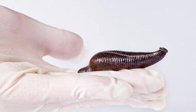 Leech cream to raise a member